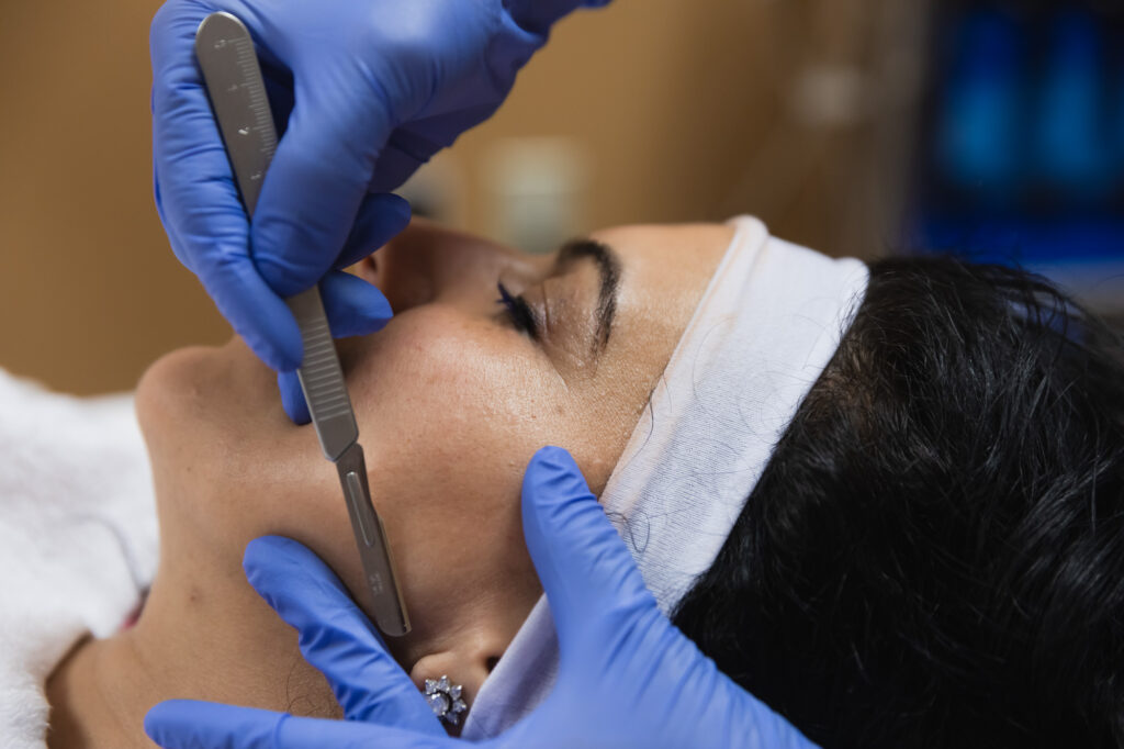 A patient undergoes Dermaplaning in Lakewood, CO