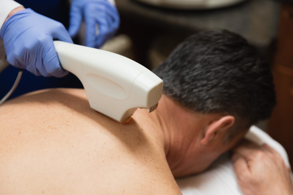 A man receives Laser Hair Removal in Denver