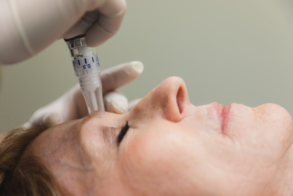 A woman receives Microneedling in Denver
