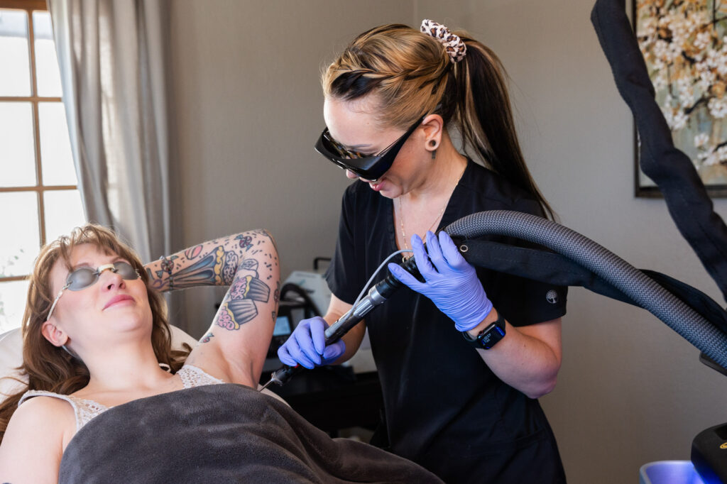 A patient receives Laser Hair Removal in Centennial, CO